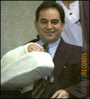 Первая трансплантация руки